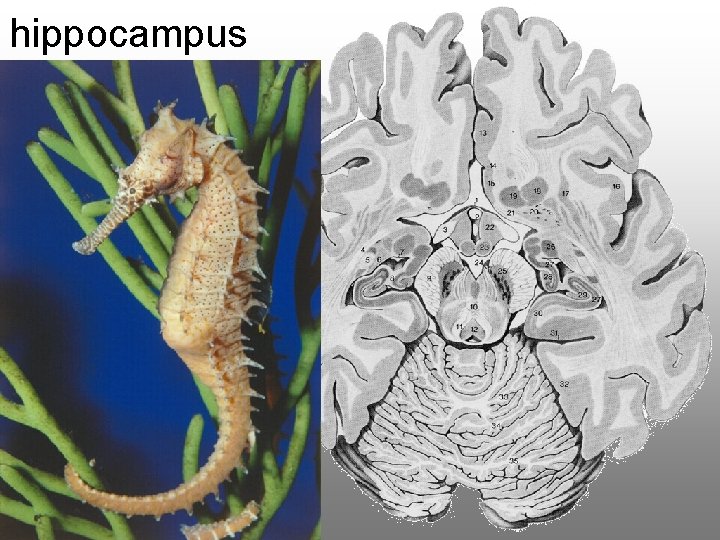 hippocampus 