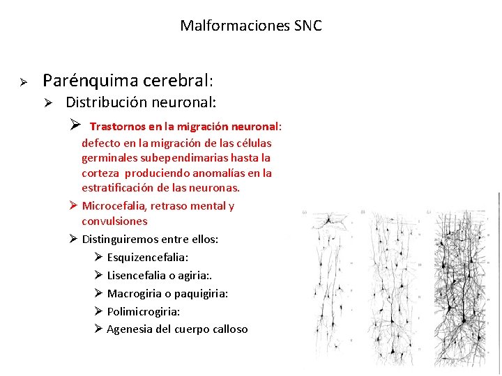 Malformaciones SNC Ø Parénquima cerebral: Ø Distribución neuronal: Ø Trastornos en la migración neuronal: