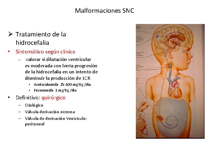 Malformaciones SNC Ø Tratamiento de la hidrocefalia • Sintomático según clínica – valorar si