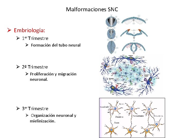 Malformaciones SNC Ø Embriología: Ø 1 er Trimestre Ø Formación del tubo neural Ø