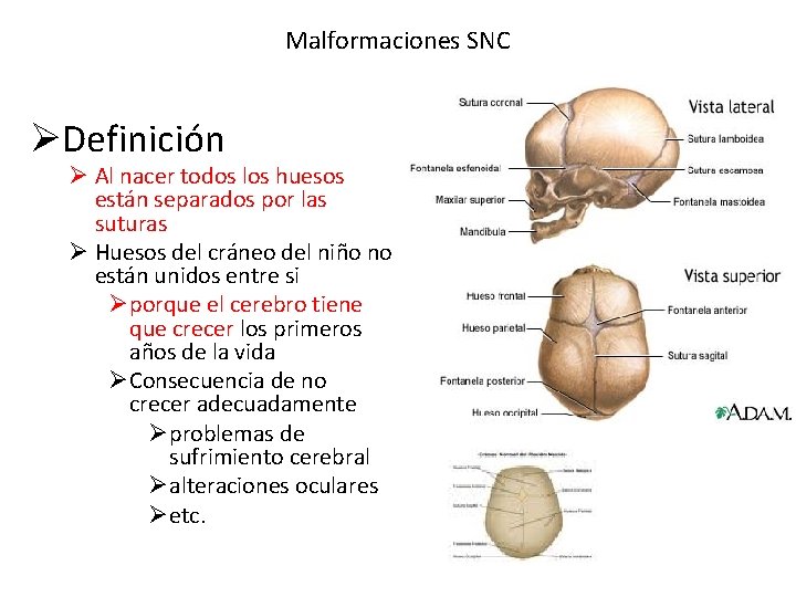 Malformaciones SNC ØDefinición Ø Al nacer todos los huesos están separados por las suturas