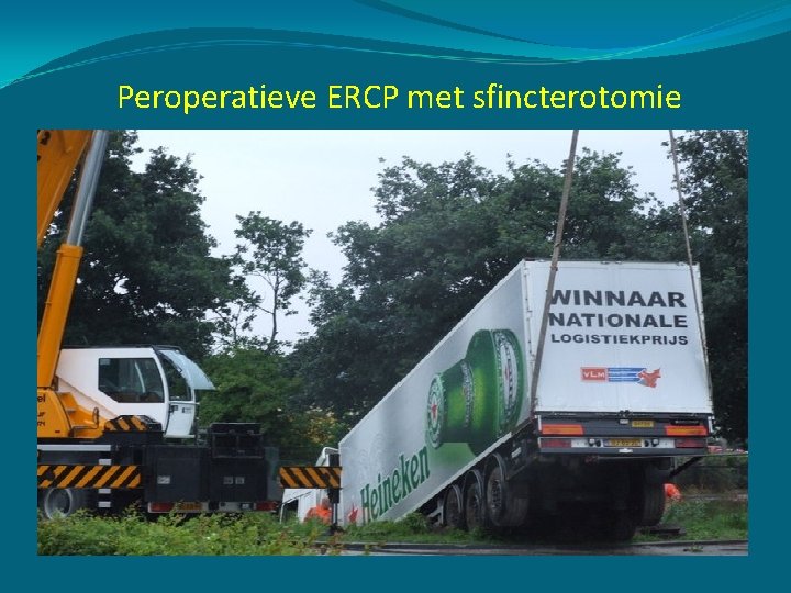 Peroperatieve ERCP met sfincterotomie ü Minder post-ERCP pancreatitis (rendez-vous) ü Minder sfincterotomieen ü Opnameduur