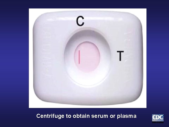 Centrifuge to obtain serum or plasma Centrifuge to obtain serum or plasma