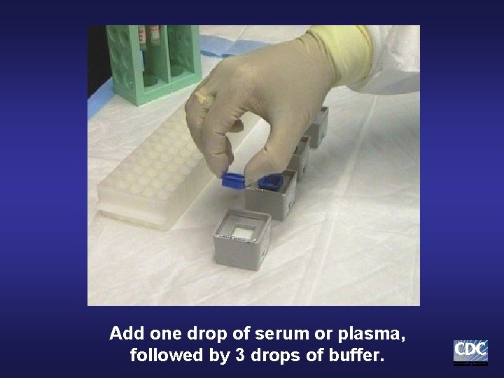 Add one drop of serum or plasma, followed by 3 drops of buffer. Add one drop of serum or plasma, followed by 3 drops of buffer.