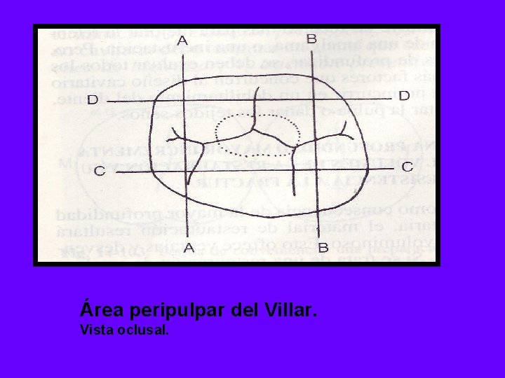 Área peripulpar del Villar. Vista oclusal. 