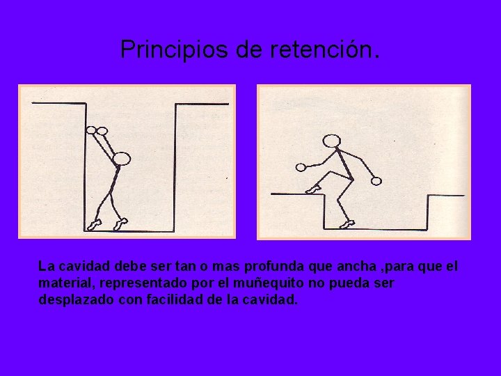 Principios de retención. La cavidad debe ser tan o mas profunda que ancha ,