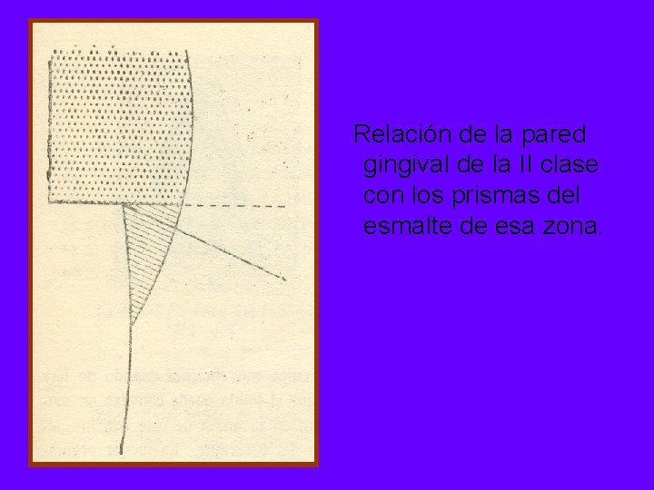  Relación de la pared gingival de la II clase con los prismas del