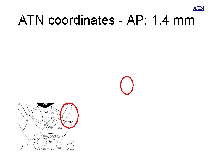 ATN coordinates - AP: 1. 4 mm 