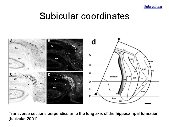 Subiculum Subicular coordinates Transverse sections perpendicular to the long axis of the hippocampal formation