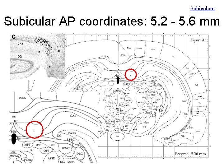 Subiculum Subicular AP coordinates: 5. 2 - 5. 6 mm 