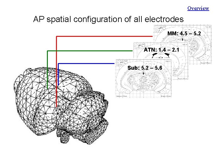 Overview AP spatial configuration of all electrodes MM: 4. 5 – 5. 2 ATN: