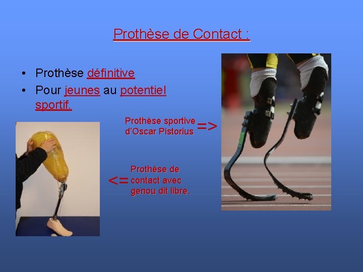 Prothèse de Contact : • Prothèse définitive • Pour jeunes au potentiel sportif. Prothèse