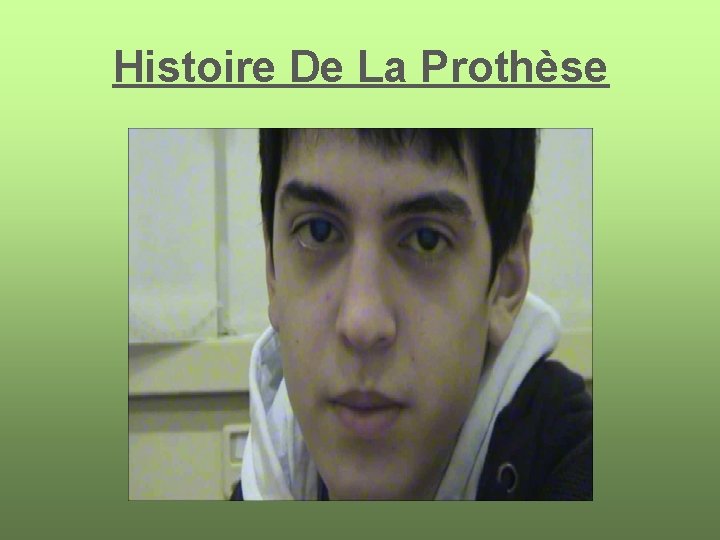 Histoire De La Prothèse 