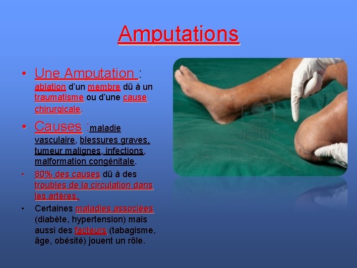Amputations • Une Amputation : Une Amputation ablation d’un membre dû à un ablation