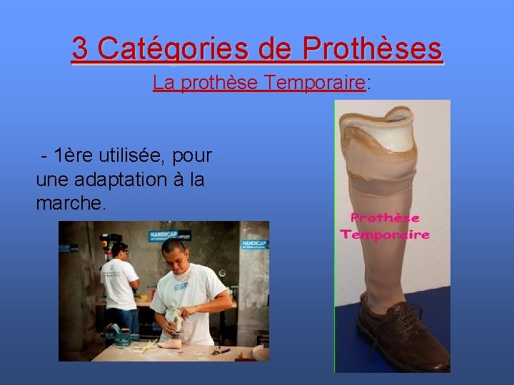 3 Catégories de Prothèses La prothèse Temporaire: - 1ère utilisée, pour une adaptation à