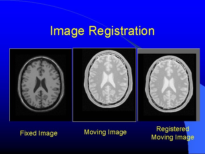 Image Registration Fixed Image Moving Image Registered Moving Image Image Registration Fixed Image Moving Image Registered Moving Image