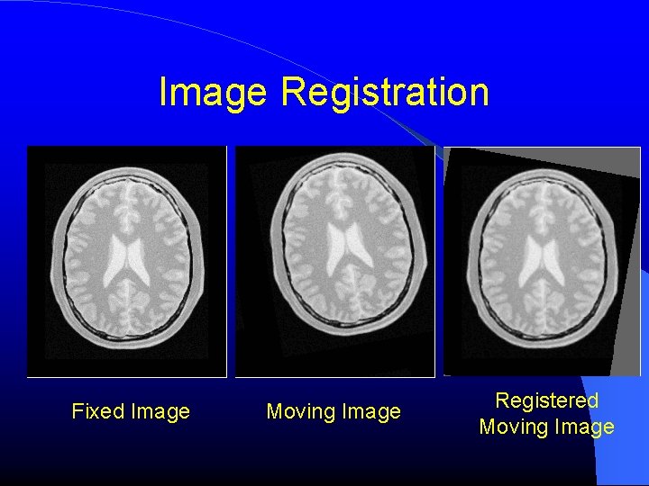 Image Registration Fixed Image Moving Image Registered Moving Image Image Registration Fixed Image Moving Image Registered Moving Image