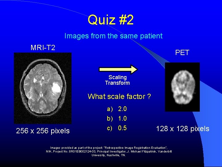 Quiz #2 Images from the same patient MRI-T 2 PET Scaling Transform What scale Quiz #2 Images from the same patient MRI-T 2 PET Scaling Transform What scale
