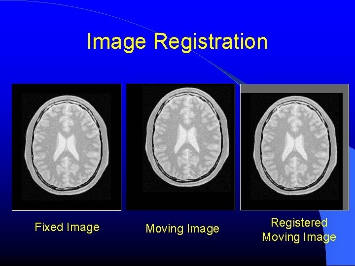 Image Registration Fixed Image Moving Image Registered Moving Image Image Registration Fixed Image Moving Image Registered Moving Image