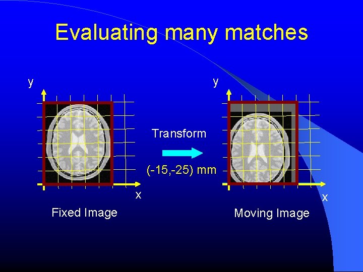 Evaluating many matches y y Transform (-15, -25) mm x Fixed Image x Moving Evaluating many matches y y Transform (-15, -25) mm x Fixed Image x Moving