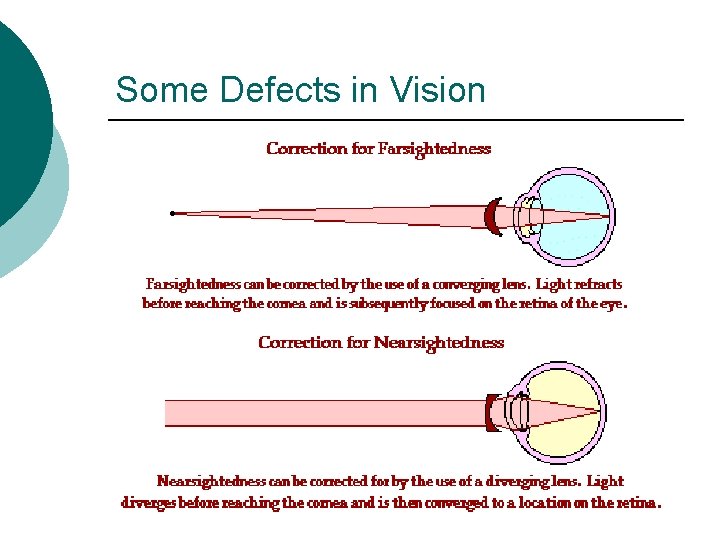 Some Defects in Vision 