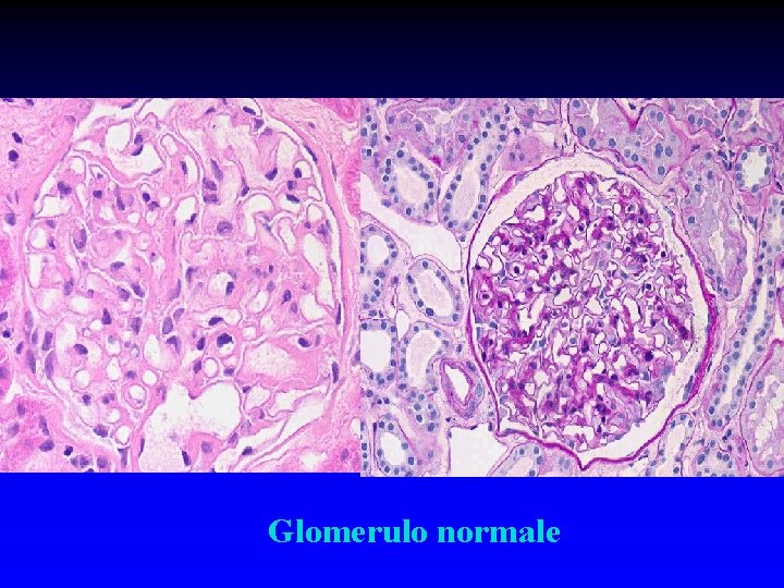Glomerulo normale 