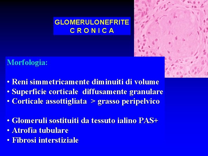 GLOMERULONEFRITE CRONICA Morfologia: • Reni simmetricamente diminuiti di volume • Superficie corticale diffusamente granulare