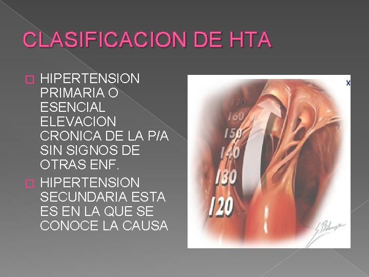 CLASIFICACION DE HTA HIPERTENSION PRIMARIA O ESENCIAL ELEVACION CRONICA DE LA P/A SIN SIGNOS