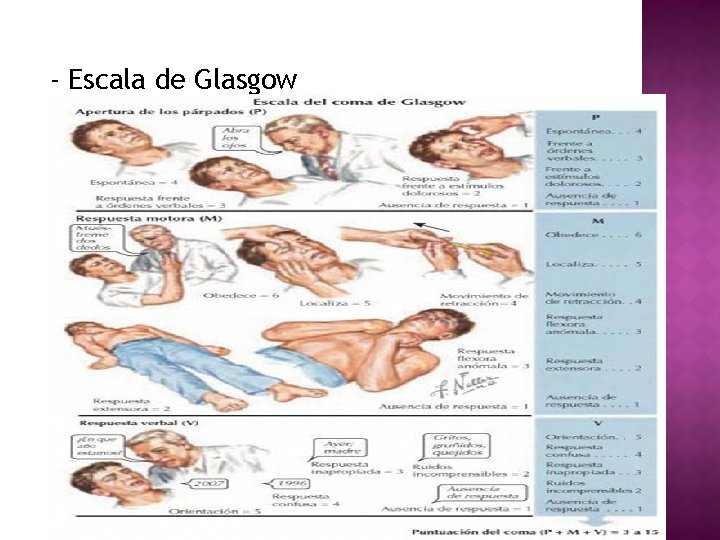 - Escala de Glasgow LIC. NORA HUARACHI ARELLANO 102 