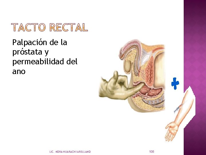 Palpación de la próstata y permeabilidad del ano LIC. NORA HUARACHI ARELLANO 108 