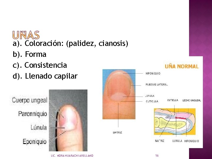 a). Coloración: (palidez, cianosis) b). Forma c). Consistencia d). Llenado capilar LIC. NORA HUARACHI