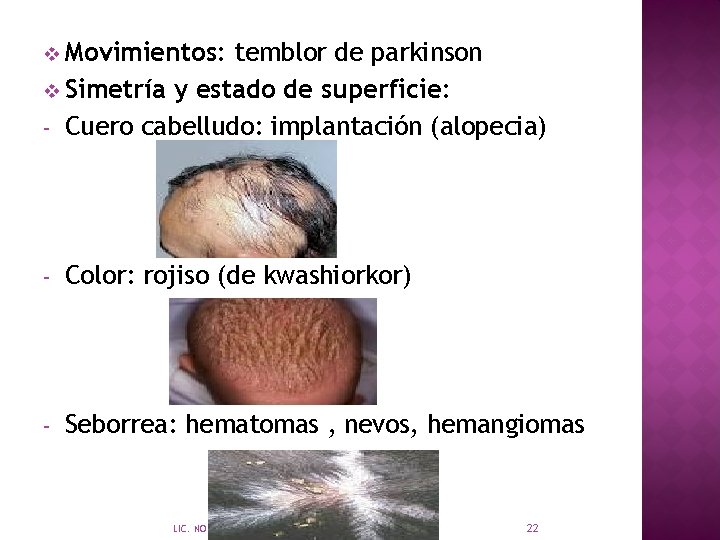 v Movimientos: temblor de parkinson v Simetría y estado de superficie: - Cuero cabelludo: