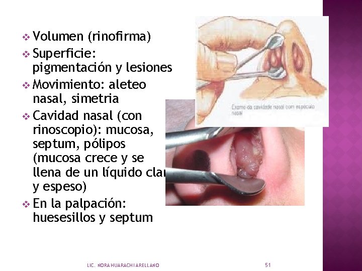 v Volumen (rinofirma) v Superficie: pigmentación y lesiones v Movimiento: aleteo nasal, simetria v