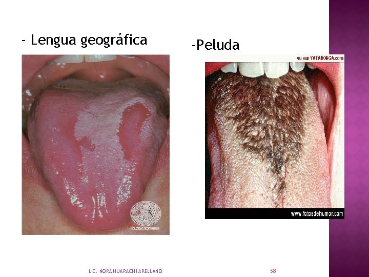 - Lengua geográfica LIC. NORA HUARACHI ARELLANO -Peluda 58 