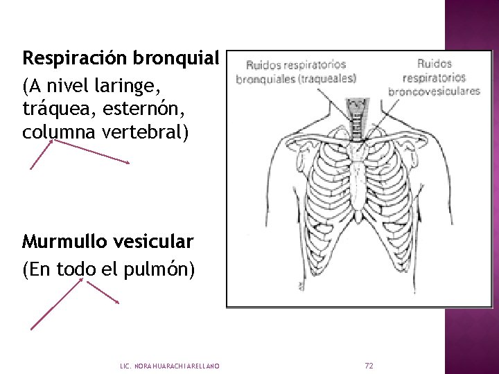 Respiración bronquial (A nivel laringe, tráquea, esternón, columna vertebral) Murmullo vesicular (En todo el