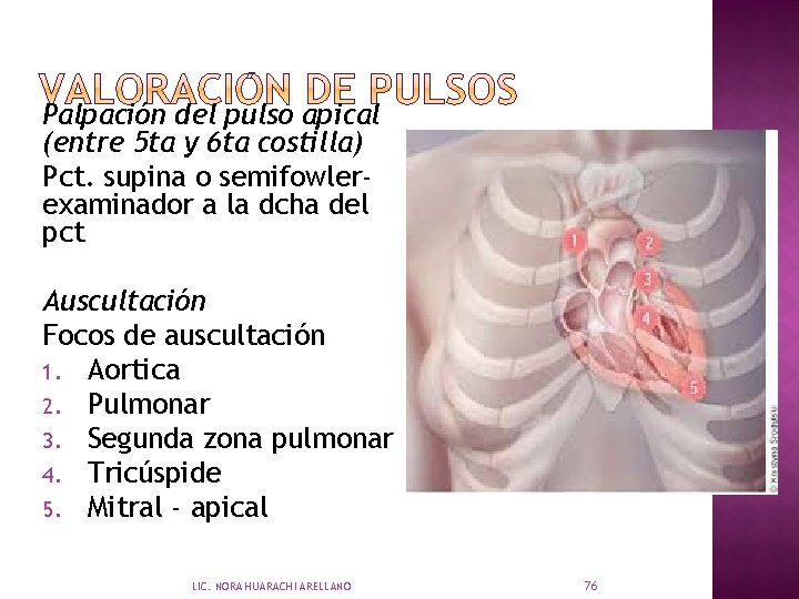 Palpación del pulso apical (entre 5 ta y 6 ta costilla) Pct. supina o