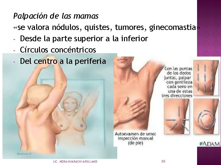 Palpación de las mamas «se valora nódulos, quistes, tumores, ginecomastia» - Desde la parte