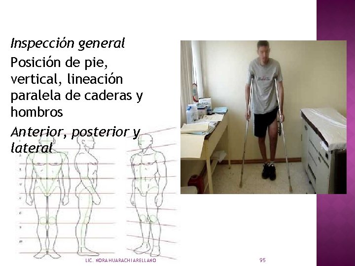 Inspección general Posición de pie, vertical, lineación paralela de caderas y hombros Anterior, posterior