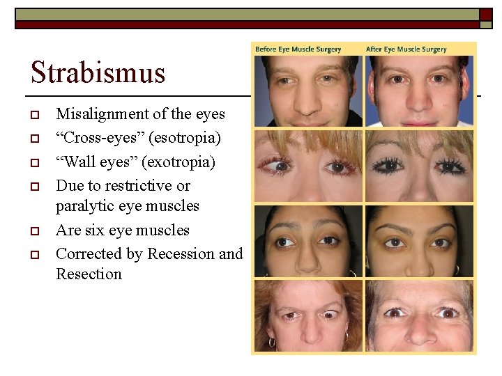 Ophthalmic Surgery Outline O O O O O