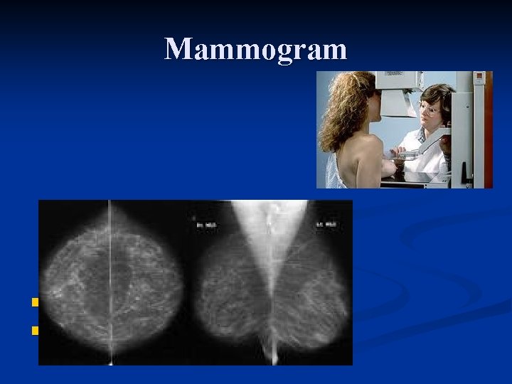 Mammogram n n Craniocaudale opname Mediolaterale opname 