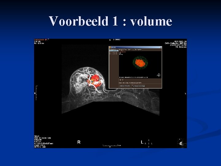 Voorbeeld 1 : volume 