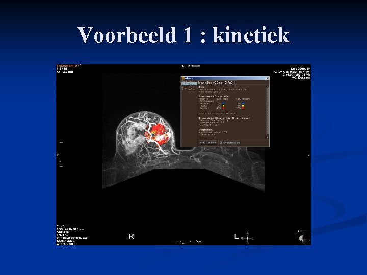 Voorbeeld 1 : kinetiek 