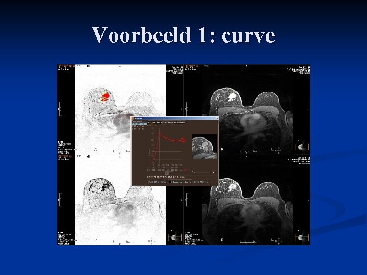 Voorbeeld 1: curve 