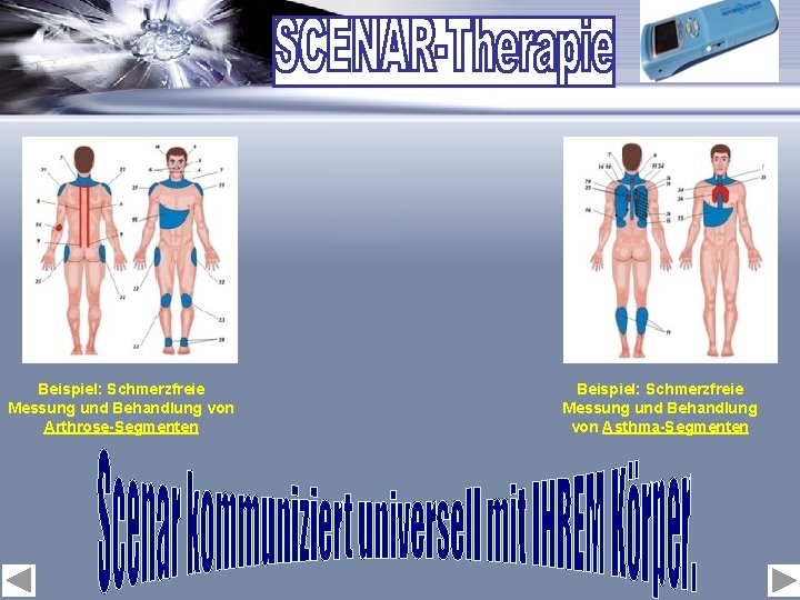 Beispiel: Schmerzfreie Messung und Behandlung von Arthrose-Segmenten Beispiel: Schmerzfreie Messung und Behandlung von Asthma-Segmenten