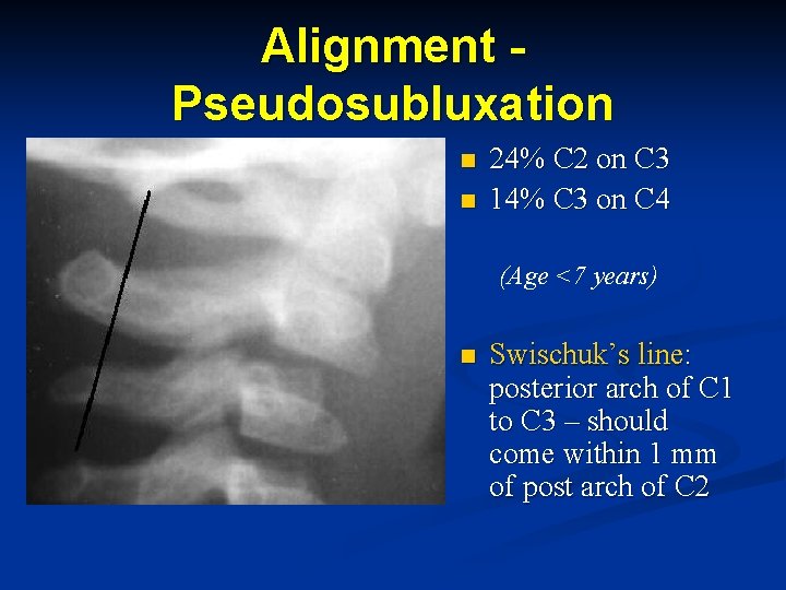 Alignment Pseudosubluxation n n 24% C 2 on C 3 14% C 3 on