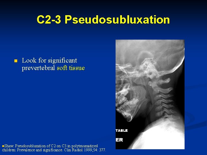 C 2 -3 Pseudosubluxation n Look for significant prevertebral soft tissue n. Shaw. Pseudosubluxation