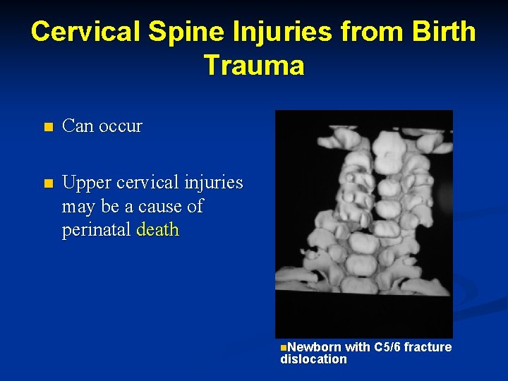 Cervical Spine Injuries from Birth Trauma n Can occur n Upper cervical injuries may