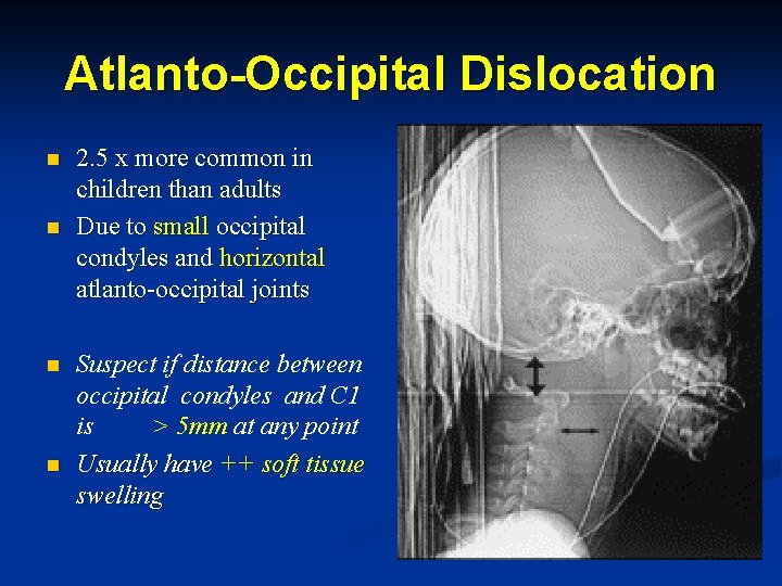 Atlanto-Occipital Dislocation n n 2. 5 x more common in children than adults Due