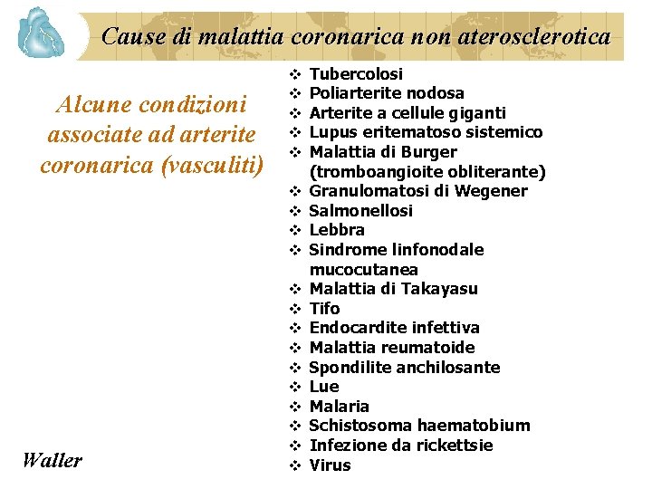 Cause di malattia coronarica non aterosclerotica Alcune condizioni associate ad arterite coronarica (vasculiti) v