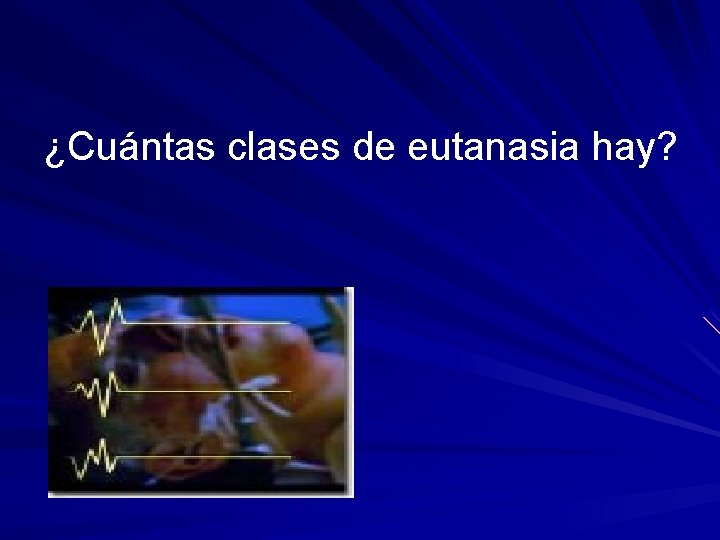 ¿Cuántas clases de eutanasia hay? ¿Cuántas clases de eutanasia hay?